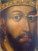 Обличчя до реставрації